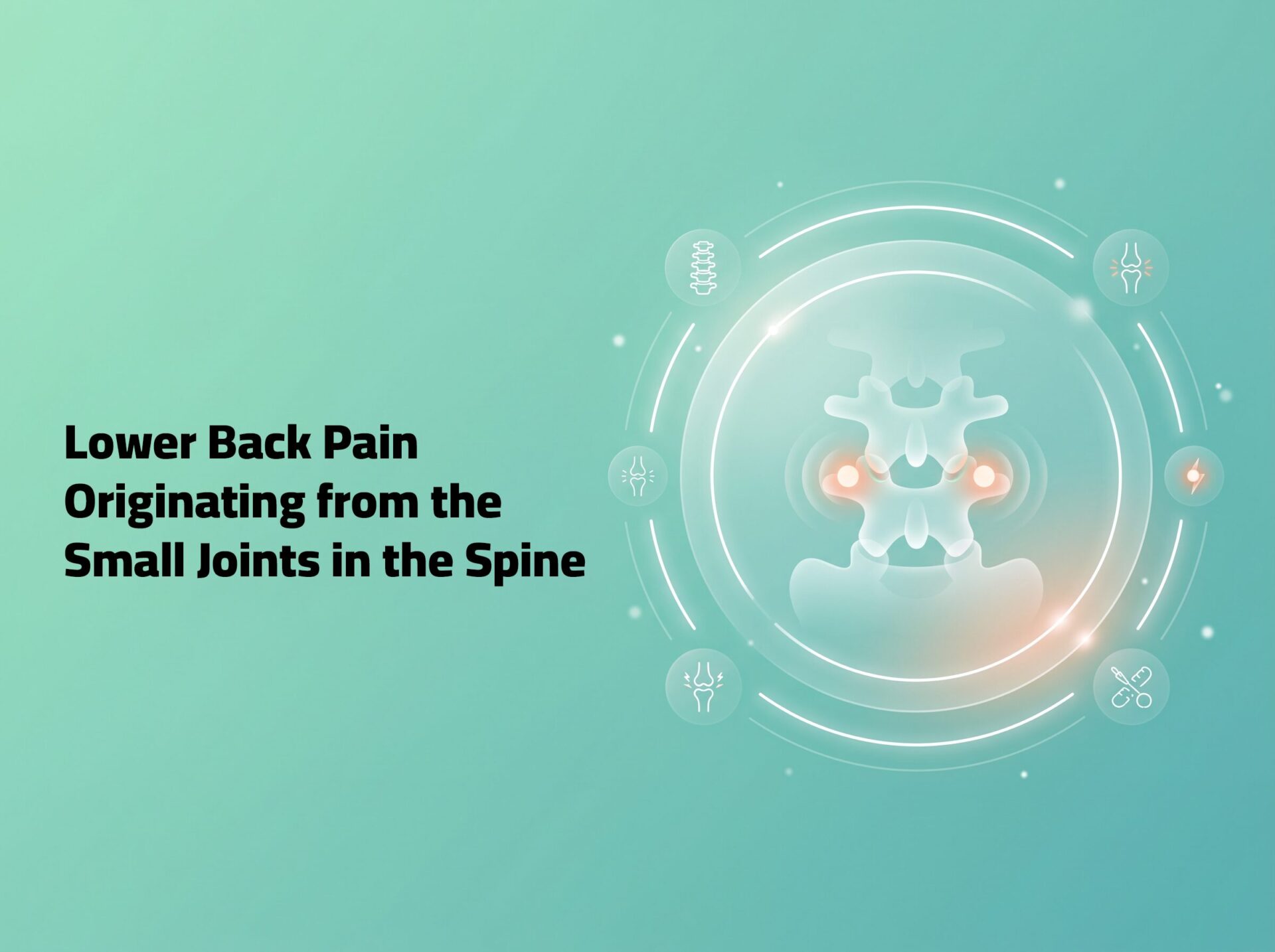 Lower Back Pain Originating from the Small Joints in the Spine
