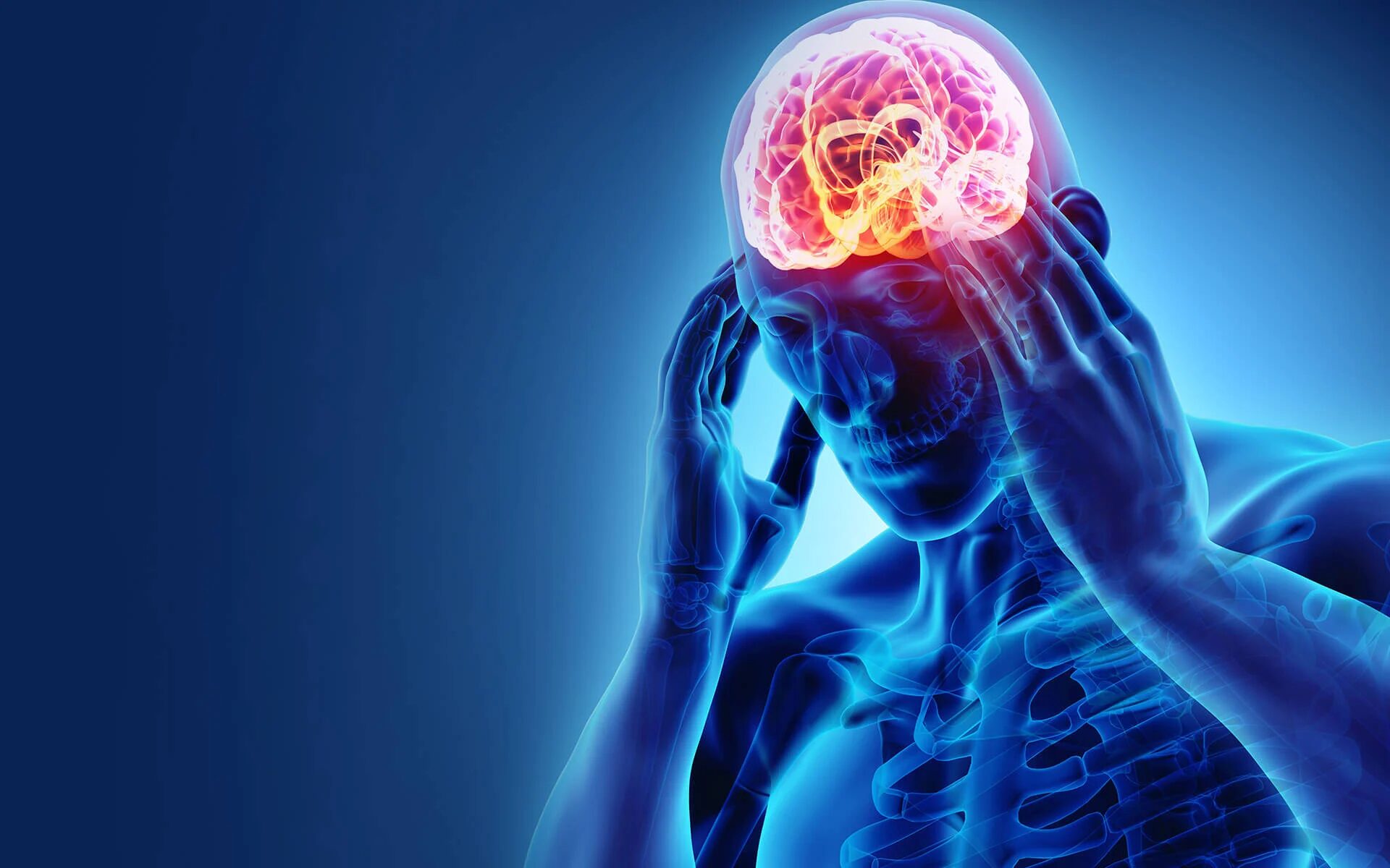 Effective Migraine Treatments: How to Manage Headaches and Prevent Episodes