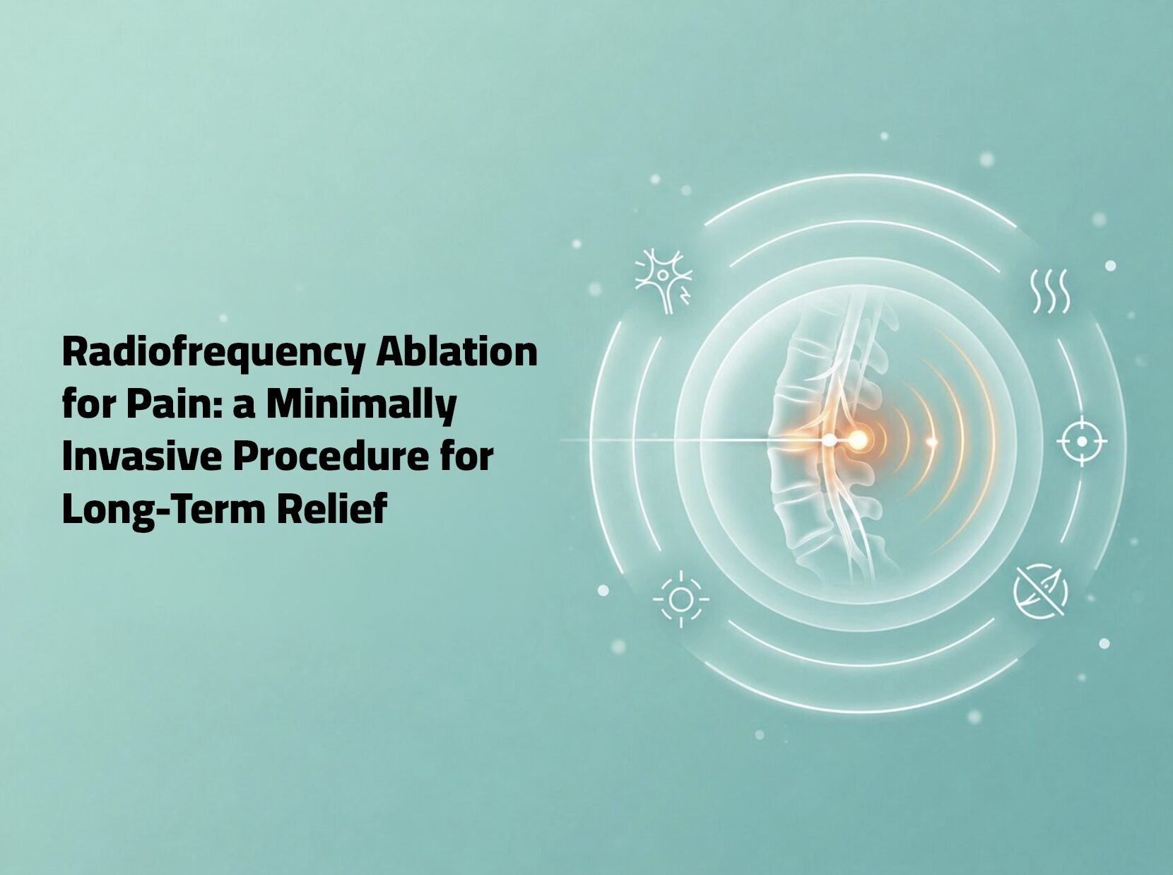 Radiofrequency Ablation for Pain- a Minimally Invasive Procedure for Long-Term Relief