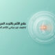 علاج الألم بالتردد الحراري.jpg