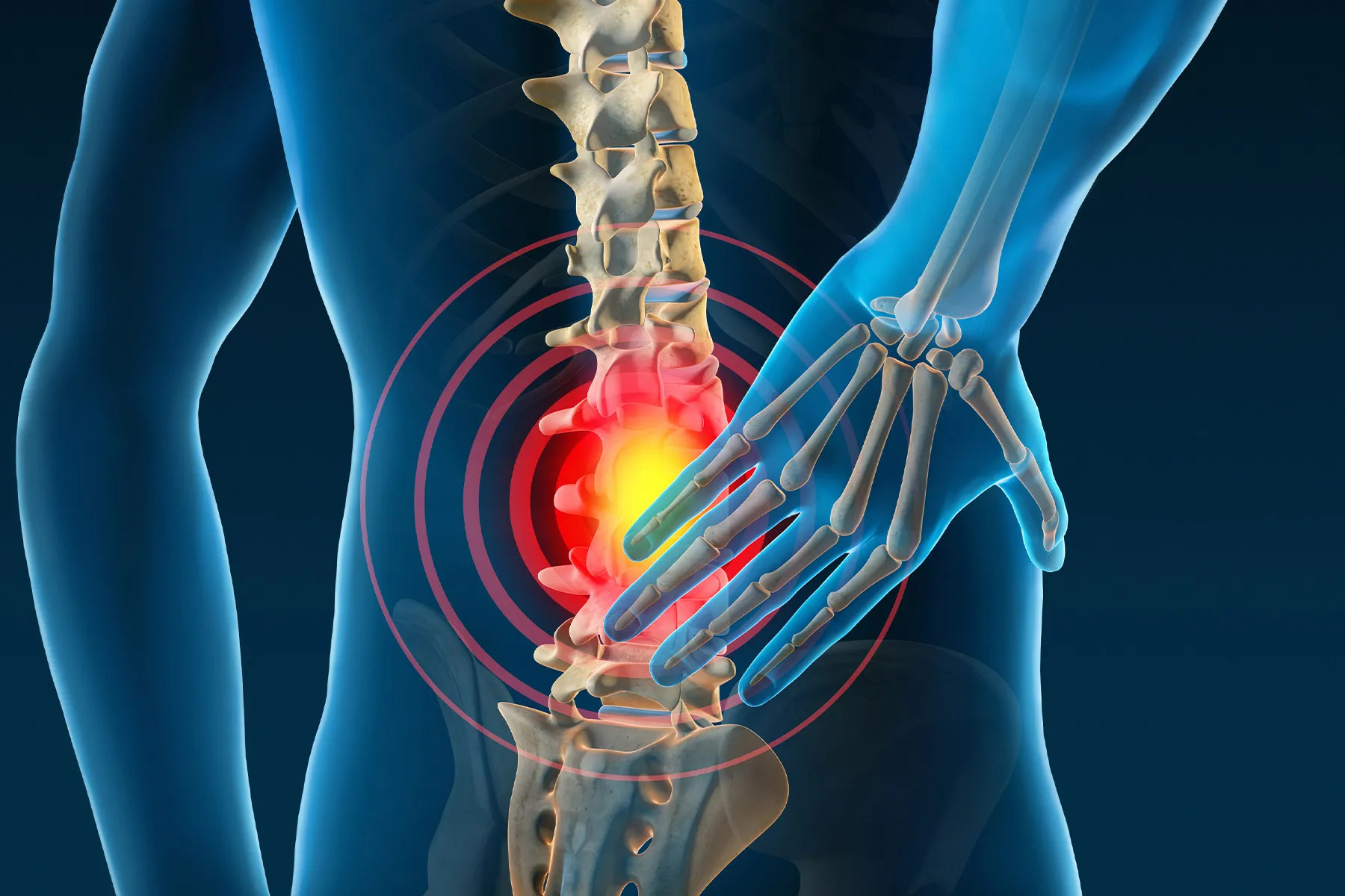 why is back pain so common